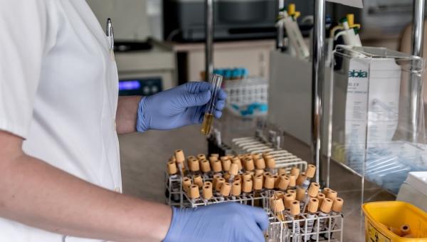 За прошедшие сутки в Прикамье выявлено 160 новых случаев коронавируса
